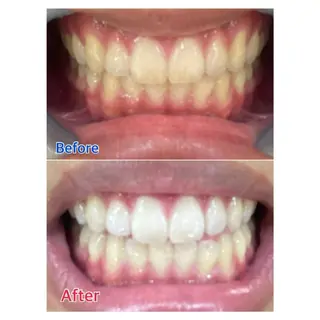 MBEAUTYSALON 千葉店・京成大久保所属・Melty 輝のその他イメージ