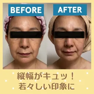 小顔矯正サロン プルメリアのエステ・リラクイメージ