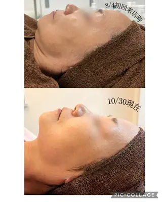 肌質改善|美眉サロンCannone'所属・肌質改善|美眉サロン Cannone’のエステ・リラクイメージ