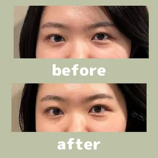 美容鍼灸サロン      APLUS所属・美容鍼灸サロン APLUSのエステ・リラクイメージ