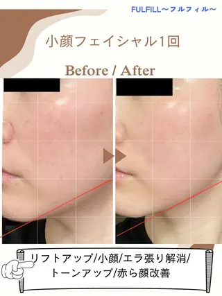 フルフィル MIYUKIのエステ・リラクイメージ