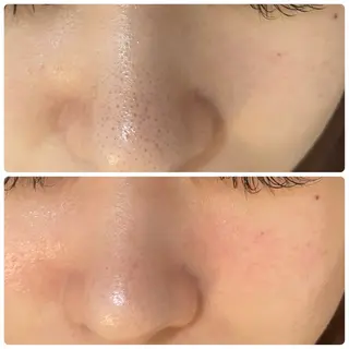 Le Cherien所属・姫路/肌管理/脱毛 Le Cherienのその他イメージ