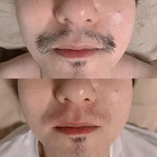 メンズ Epina 千葉店 【エピナ】のエステ・リラクイメージ