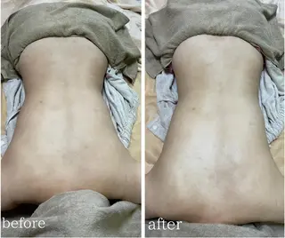 calimelo所属・calimero 美肌脱毛サロンの眉毛・アイブロウイメージ