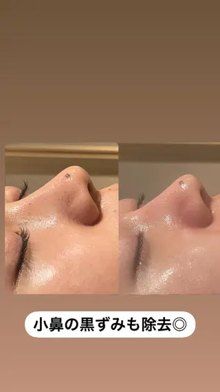 メンズ眉毛ITSUK Iメンズ専門　新宿の眉毛・アイブロウイメージ