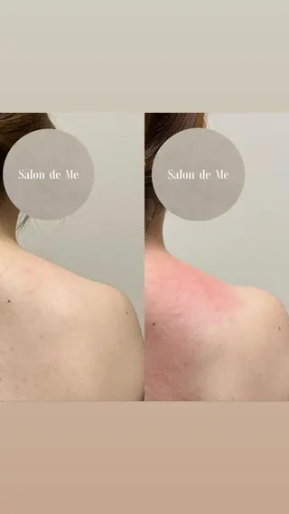 Salon de Me所属・💫Salon de Me💫予約停止中のエステ・リラクイメージ