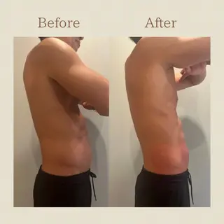 お腹痩せエステ Flat BELLY 恵比寿所属・【腸もみ/冷却痩身】 お腹エステ/恵比寿のエステ・リラクイメージ