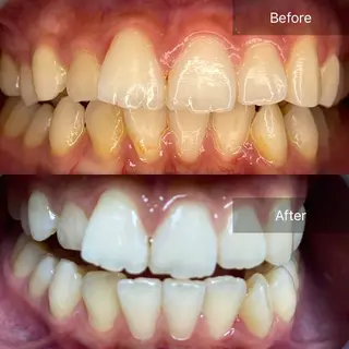 ネイル ストーリー所属・セルフホワイトニング 耳ツボジュエリーのエステ・リラクイメージ