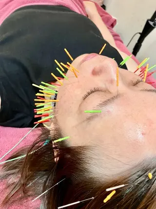 美容鍼灸女性専用 りんご鍼灸治療院のエステ・リラクイメージ