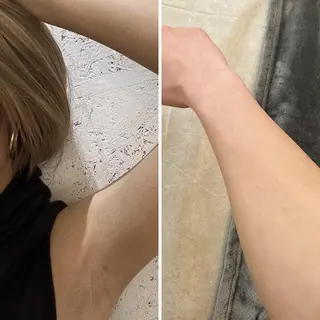 うなじ脱毛/美肌脱毛 LABELのエステ・リラクイメージ