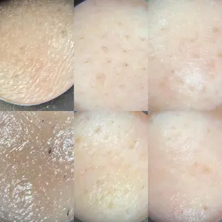 メナードフェイシャルサロン　リンガーデン所属・山口 郁代のエステ・リラクイメージ