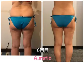 A.mstic 美肌、美ボディ専門店のエステ・リラクイメージ