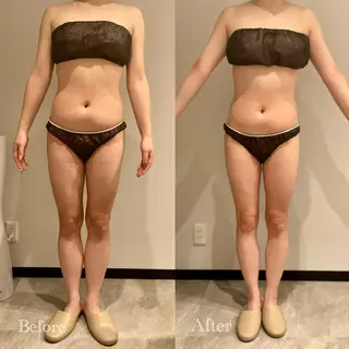 Esthetic MiEUXのエステ・リラクイメージ