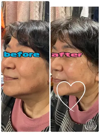 kuppy所属・lymph coconのエステ・リラクイメージ