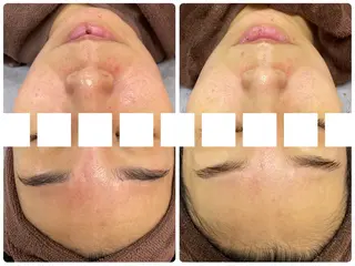 ResetLab 佐藤 風香のエステ・リラクイメージ