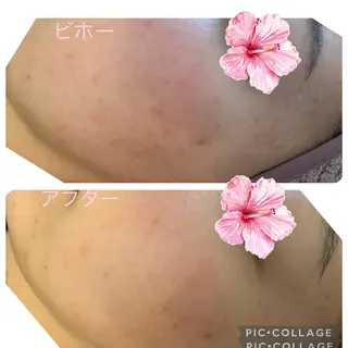 いやし工房LiLy ヘッド小顔ケアサロンのエステ・リラクイメージ