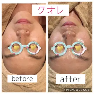 美肌専門salon クオレのエステ・リラクイメージ