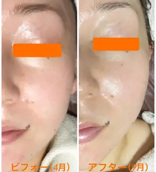 小顔・毛穴・たるみ ネイル　似内真樹のエステ・リラクイメージ