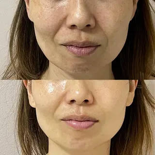 本気の小顔×毛穴ケア ／もりやま はるかのエステ・リラクイメージ