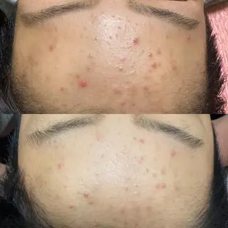 eyelash・aesthetic salon KANARU所属・KANARU ♡真七海♡のマツエク・マツパデザイン