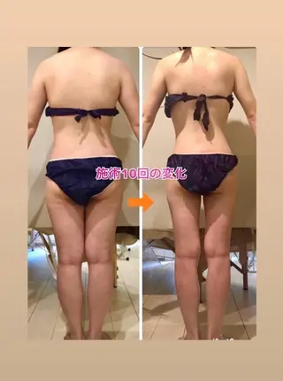 ショート カラー パーマ ヘアアレンジ メンズ キッズ ネイル マツエク・マツパ ‍痩身＆ボディ 結果出し🌟丹野のエステ・リラクイメージ