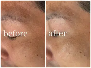 クラスペディア脱毛 ・フェイシャル専門店のエステ・リラクイメージ