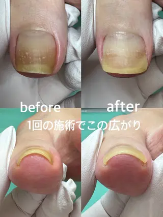 Lise footcareのネイルデザイン