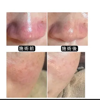 渋谷 小顔美容鍼 専門サロン YZのエステ・リラクイメージ