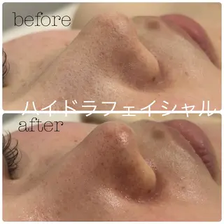 メンズ フェイシャルサロン CHIARA 荒田のエステ・リラクイメージ