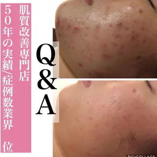 ミディアム カラー パーマ ヘアアレンジ メンズ キッズ ネイル マツエク・マツパ ニキビ・肌質改善専門 ♡人生が変わるサロンのエステ・リラクイメージ