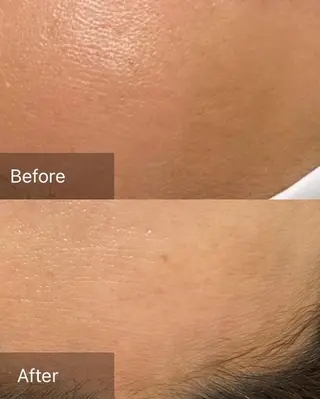 産毛専門店 Bittoのエステ・リラクイメージ