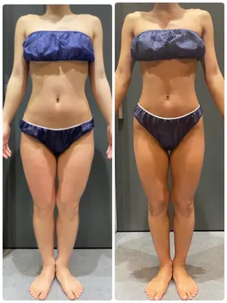 レイビス 渋谷店のエステ・リラクイメージ