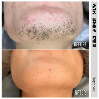 メンズ Rappore; 心斎橋 みずきのエステ・リラクイメージ