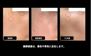 ヴィーナス ビューティーのエステ・リラクイメージ