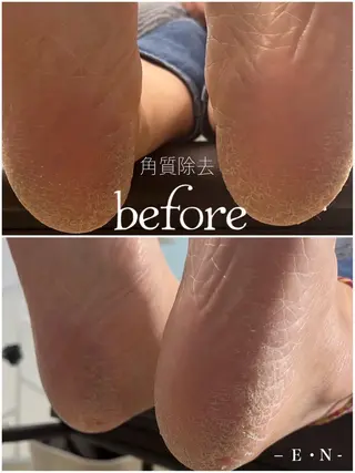 E・N(エン)所属・E・N(エン) eyelashのマツエク・マツパデザイン