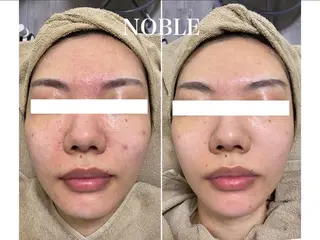 NOBLE 新宿本店のエステ・リラクイメージ