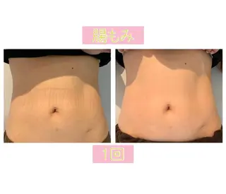 癒し腸もみサロン シャユーム　ゆきなのエステ・リラクイメージ