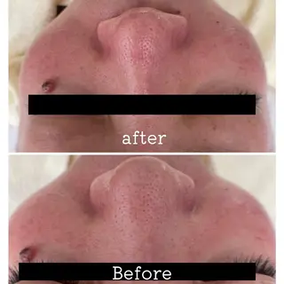 É LINDA所属・E LINDAのネイルデザイン