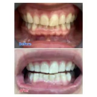 MBEAUTYSALON 千葉店・京成大久保所属・Melty 輝のその他イメージ