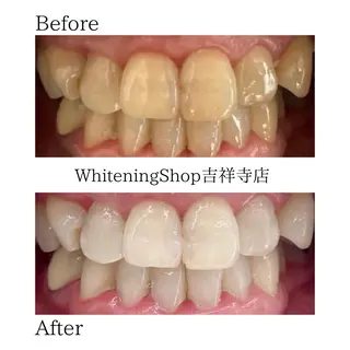 ホワイトニング ショップ吉祥寺店のエステ・リラクイメージ