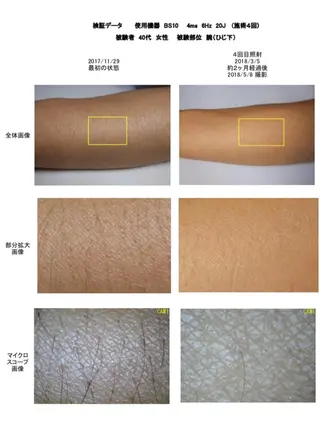 セルフ脱毛&セルフエステ　onesalon  ワンサロン姫路所属・セルフ脱毛 One Salonのエステ・リラクイメージ