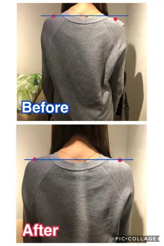 鍼灸整骨院Refine所属・鍼灸 Refineのその他イメージ