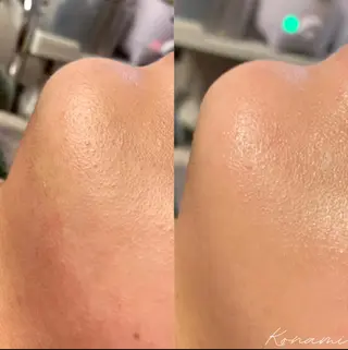 シードリン 府内店 小波のエステ・リラクイメージ