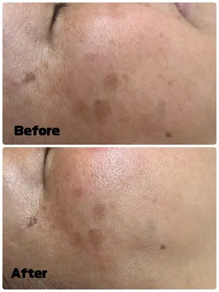 Param所属・Param Femcareのエステ・リラクイメージ