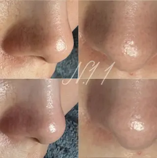 beauty salon N.11所属・beauty salonN.11のエステ・リラクイメージ