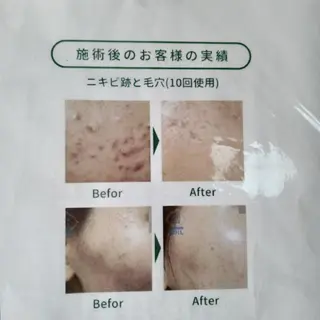 Ｂ まぁ〜じょのエステ・リラクイメージ