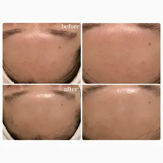 Lily branc 痩身/小顔/肌質改善のエステ・リラクイメージ