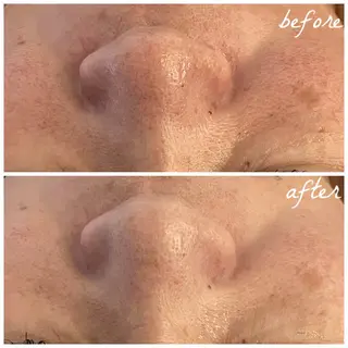 メンズ メナード岐阜市茜部 杉浦のエステ・リラクイメージ