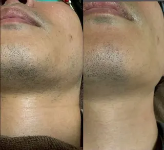 六本木脱毛andS さおりのエステ・リラクイメージ