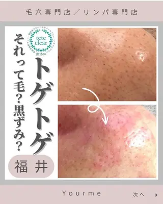 毛穴肌質ケアサロン Yourmeユアミーのエステ・リラクイメージ